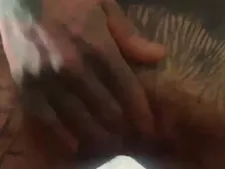 Skar 20