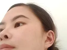 Lindanbeo00 18